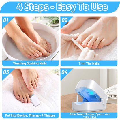 Rechargeable Nail Fungus Laser – Anti-Fungal Device Toenails, Hands & Feet (Home Use)